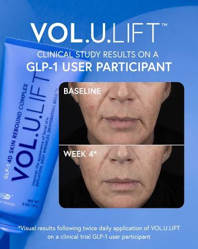 VOL-U-LIFT